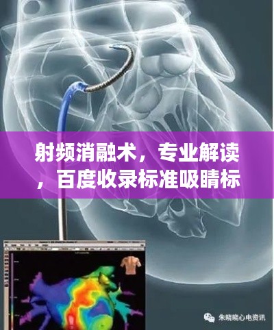 射频消融术,专业解读,百度收录标准吸睛标题!